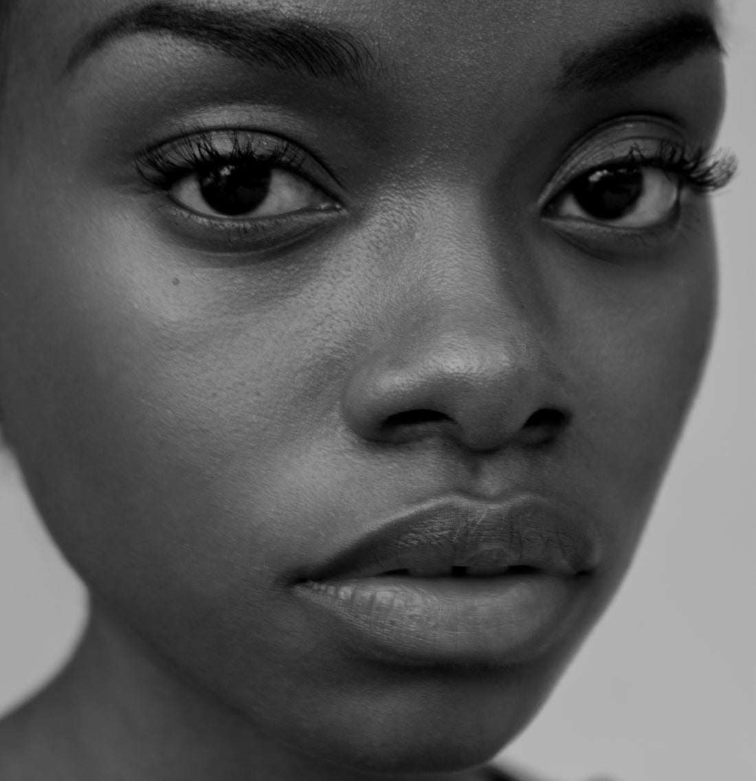 Why dry skin in the summer is more common than you think